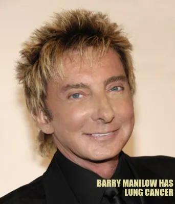 Barry Manilow has lung cancer