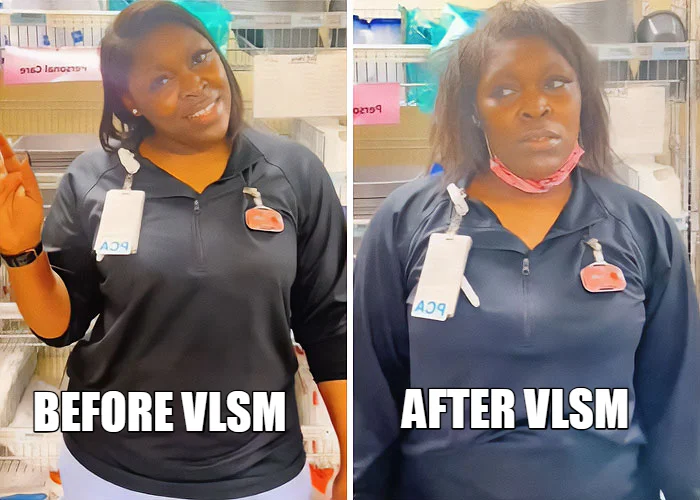 BEFORE VLSM — AFTER VLSM