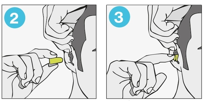 How to protect yourself from hantavirus